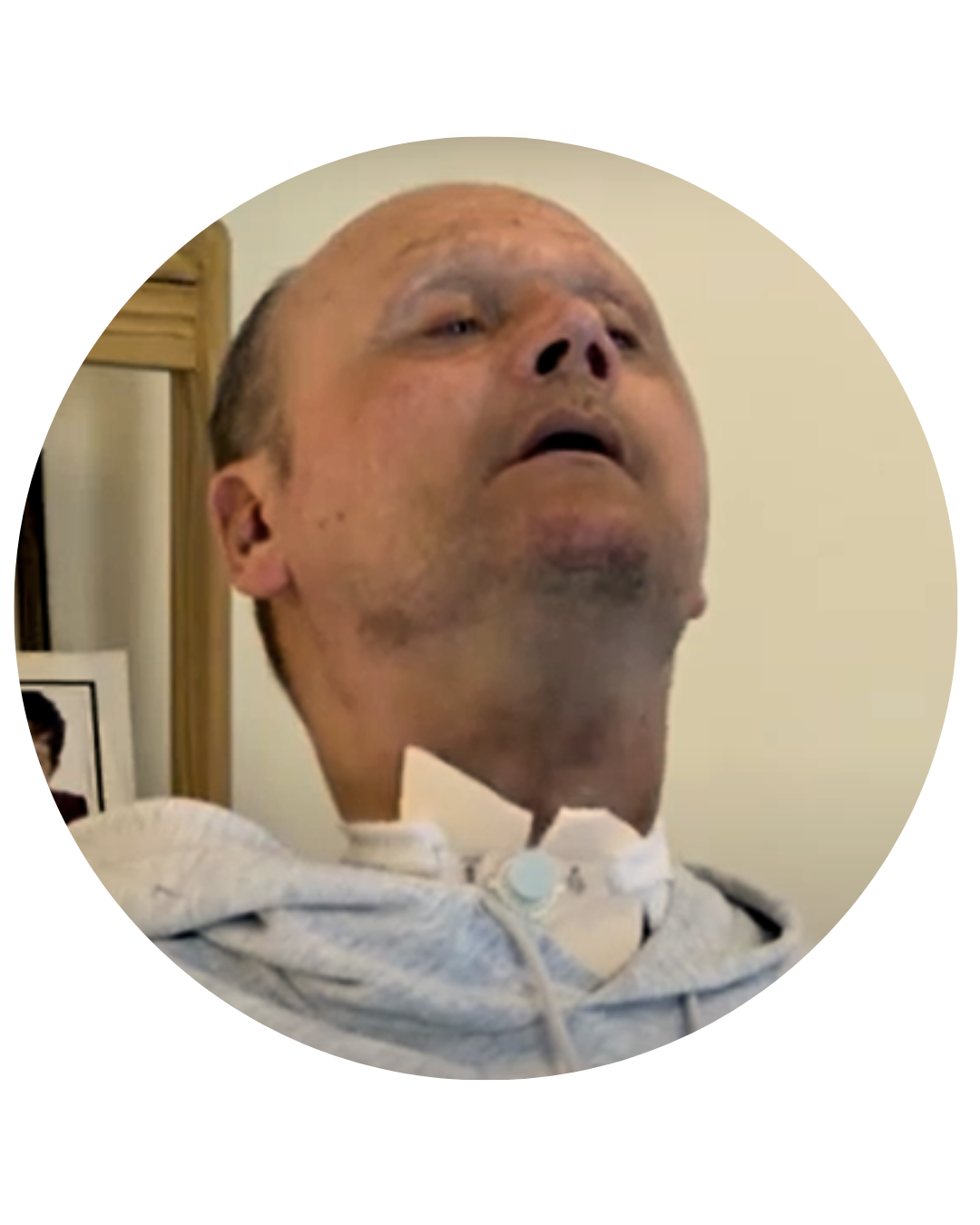 Jamie Hood, former Yorkshire cricket player, supported by Komplex Care after becoming fully paralysed