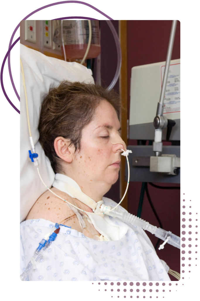 Adult client receiving nurse-led complex care support at home with tracheostomy care needs