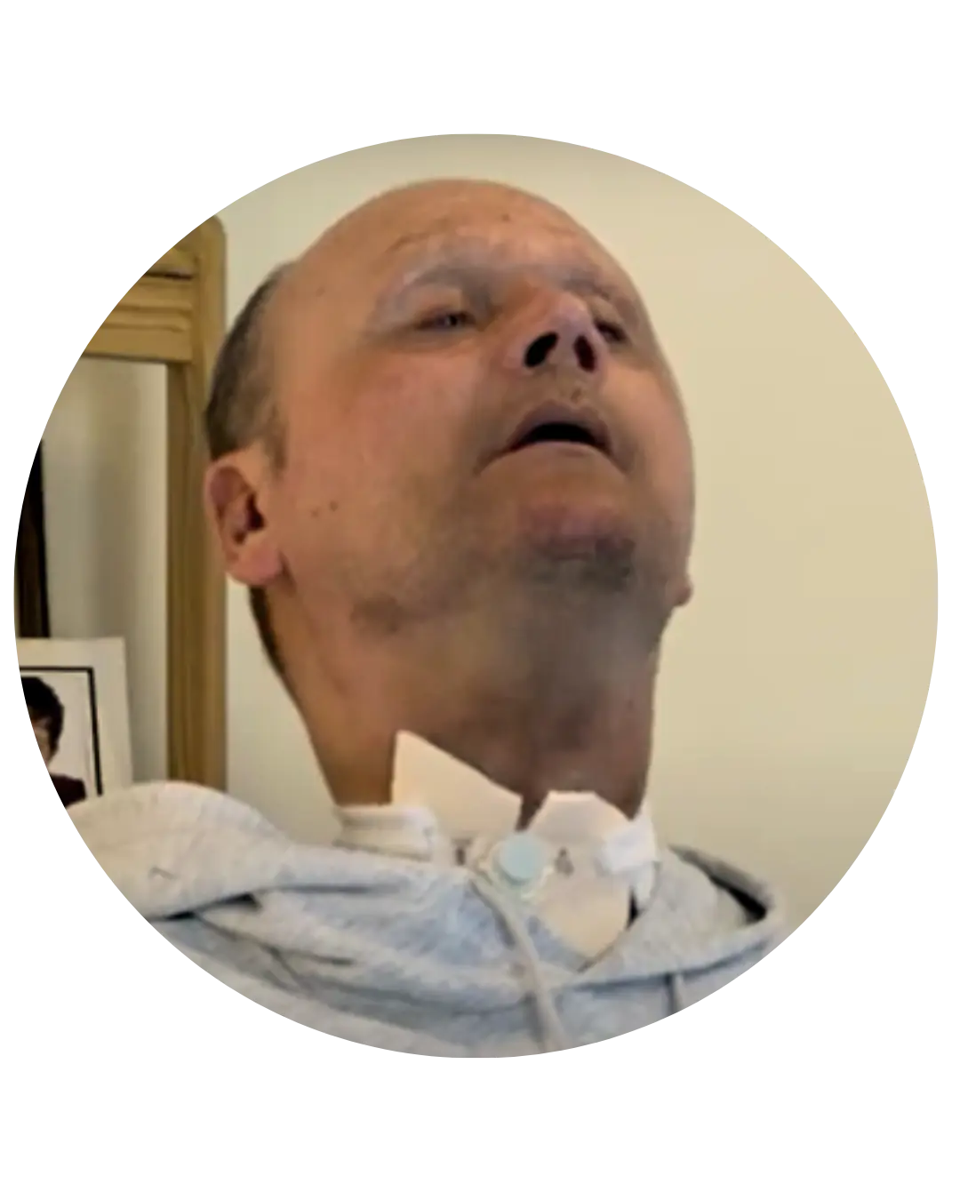 Jamie Hood, former Yorkshire cricket player, supported by Komplex Care after becoming fully paralysed